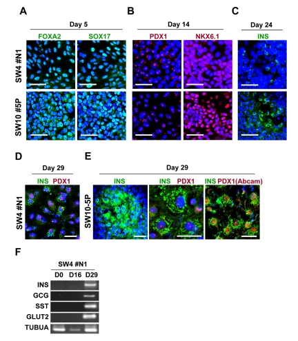 Guided in vitro differentiation of patient iPS cells into insulin-producing islet-like cells