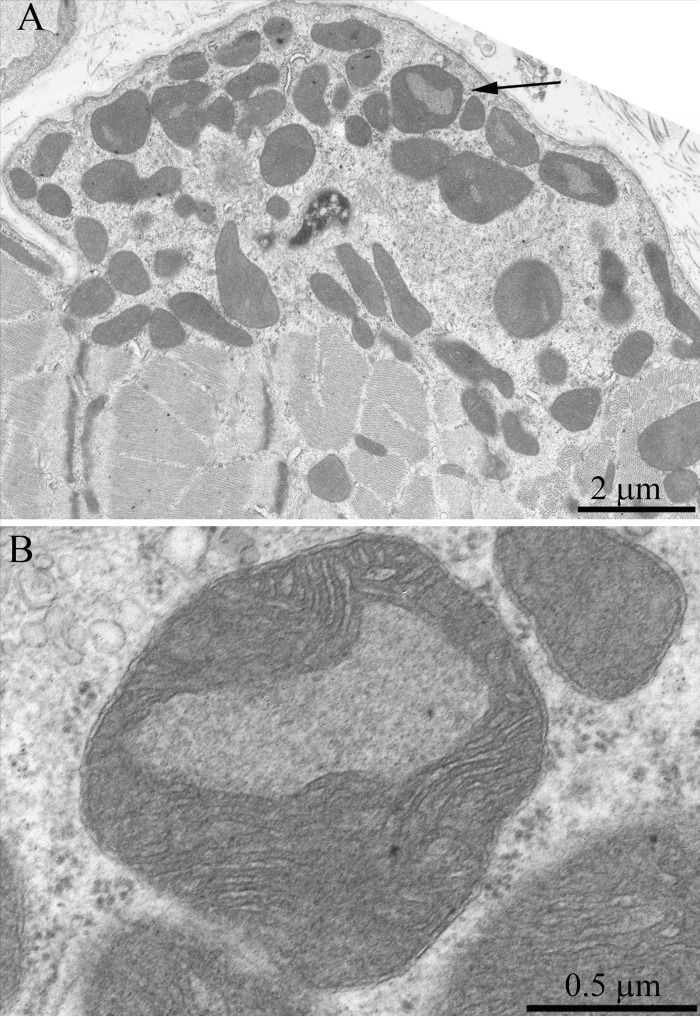(A) Subsarcolemmal population of mitochondria of a three-month-old OXYS rat. The arrow indicates the mitochondrion presented in (B) at higher magnification. One can see a large cristae-free region occupied by a homogenous content of a low electron density.