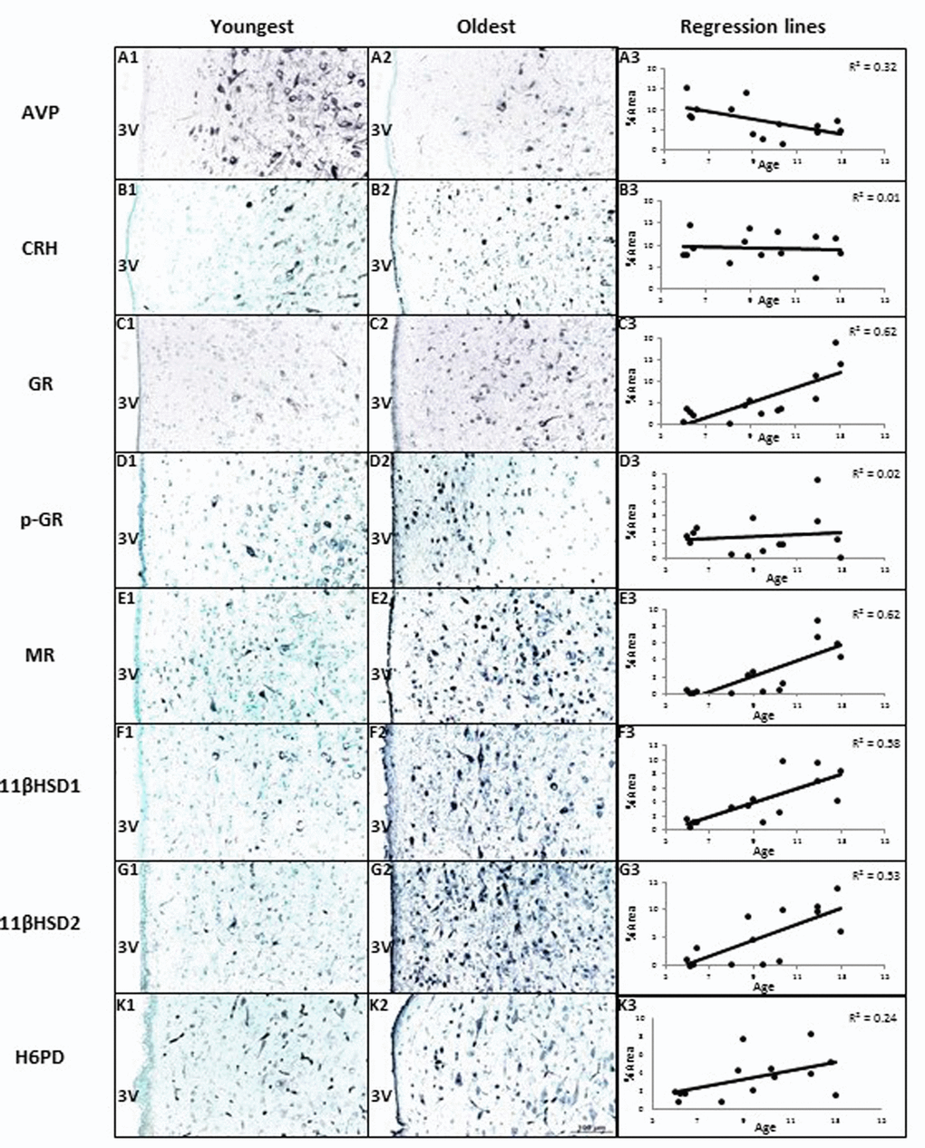 The effects of age on area% positive staining of HPAA proteins in hypothalamus of female baboons (P. hamadryas). Columns A1-K1 and A2-K2 show the youngest and oldest photomicrographs. Column A3-K3 shows correlations between age and peptides of hypothalamus. Linear regression showed AVP expression was negatively correlated with age (R = -0.57, P P P > 0.05). The expression of H6PD tended to correlate positively with age in the PVN of hypothalamus (R = 0.49, P = 0.08). Scale bar (100µm) applies to all micrographs.