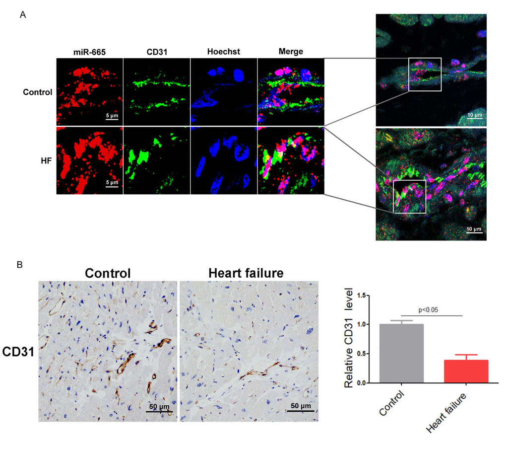 MiR-665 is up-regulated in endothelial cells of human heart with heart failure. (A) miR-665 increased a lot in endothelial cells of human heart by RNA fluorescent in situ hybridization (FISH) assay (CD31 is a maker for endothelial cells). (B) Representative immunohistochemical staining of CD31 in human heart (control, n = 2; heart failure [HF], n = 5).