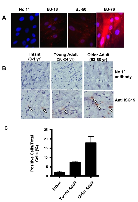 ISG15 is increased in human skin with aging