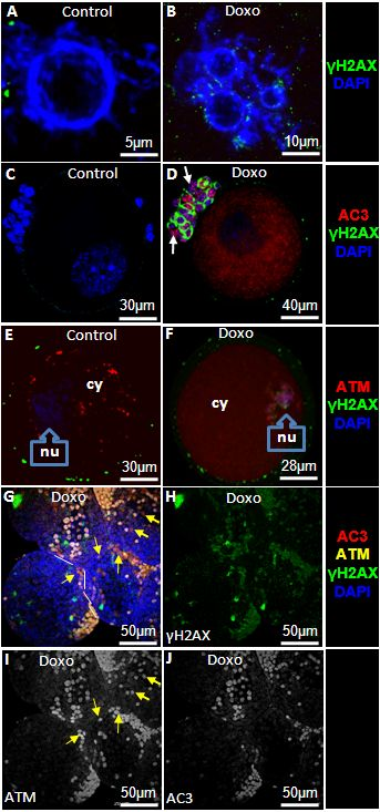 Doxorubicin induces double strand DNA breaks, activates ATM, and causes apoptosis in mouse oocytes