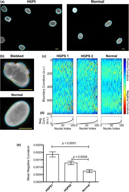 The boundary curvature of HGPS and normal nuclei