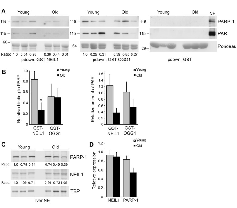 Decreased binding of PARP-1 to GST-NEIL1 with mouse age