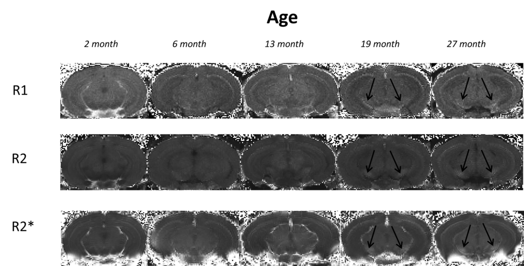 Typical 3I R1, R2 and R2* maps of brains at approximate bregma -3.28 from mice aged 2, 6, 13, 19 and 27 month in study 1. Black arrows indicate the substantia nigra.