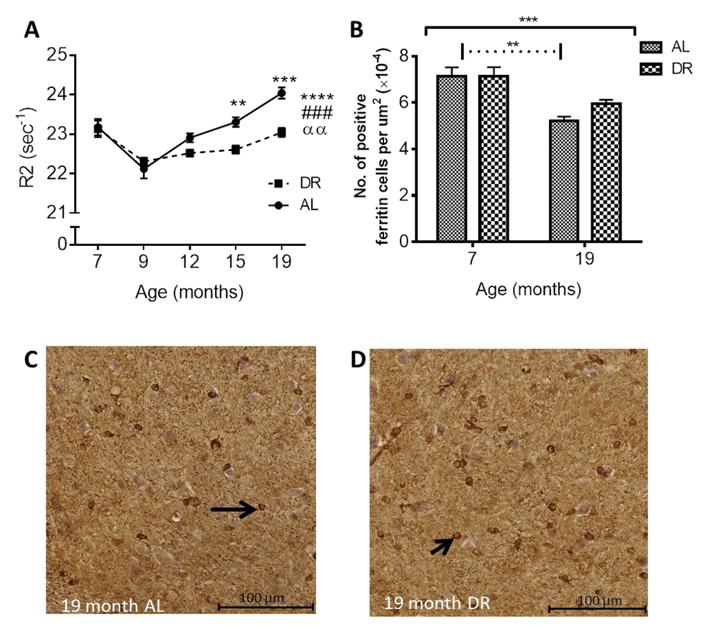 (A) Dietary restriction ameliorates age-related increases in in vivo R2 in the SN. Black asterisks placed above specific age time points indicate differences between Ad libitum (AL) and dietary restricted (DR) mice after post-hoc test (significance levels ** P P P B) Age-related reductions in ferritin-immunopositive cell numbers in the SN between 7 and 19 months are ameliorated in DR mice compared to AL mice. [Solid black line indicates the outcome of two-way ANOVA testing; *** P C) AL compared to (D) DR mice at 19 months of age. Black arrows point to ferritin-immunopositive cells.