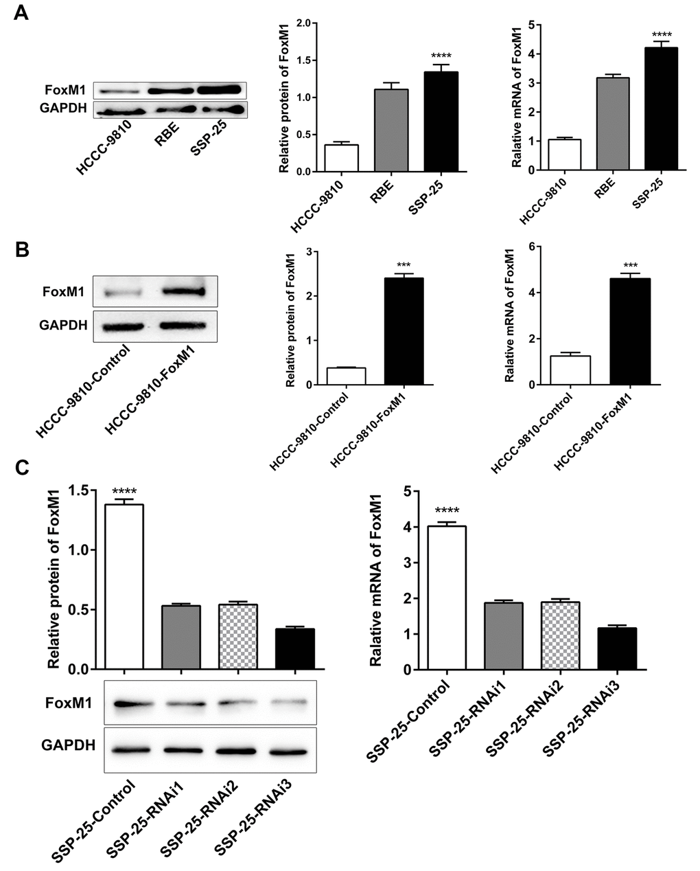Selection and establishment of stably transfected ICC cell lines with FoxM1. (A) The protein and mRNA expression of FoxM1 in ICC cell lines (HCCC-9810, RBE, and SSP-25). Western blotting and qRT-PCR analysis showed successful overexpression (B) and knockdown (C) of FoxM1 in ICC cells (HCCC-9810 and SSP-25, respectively). ***P ****P 