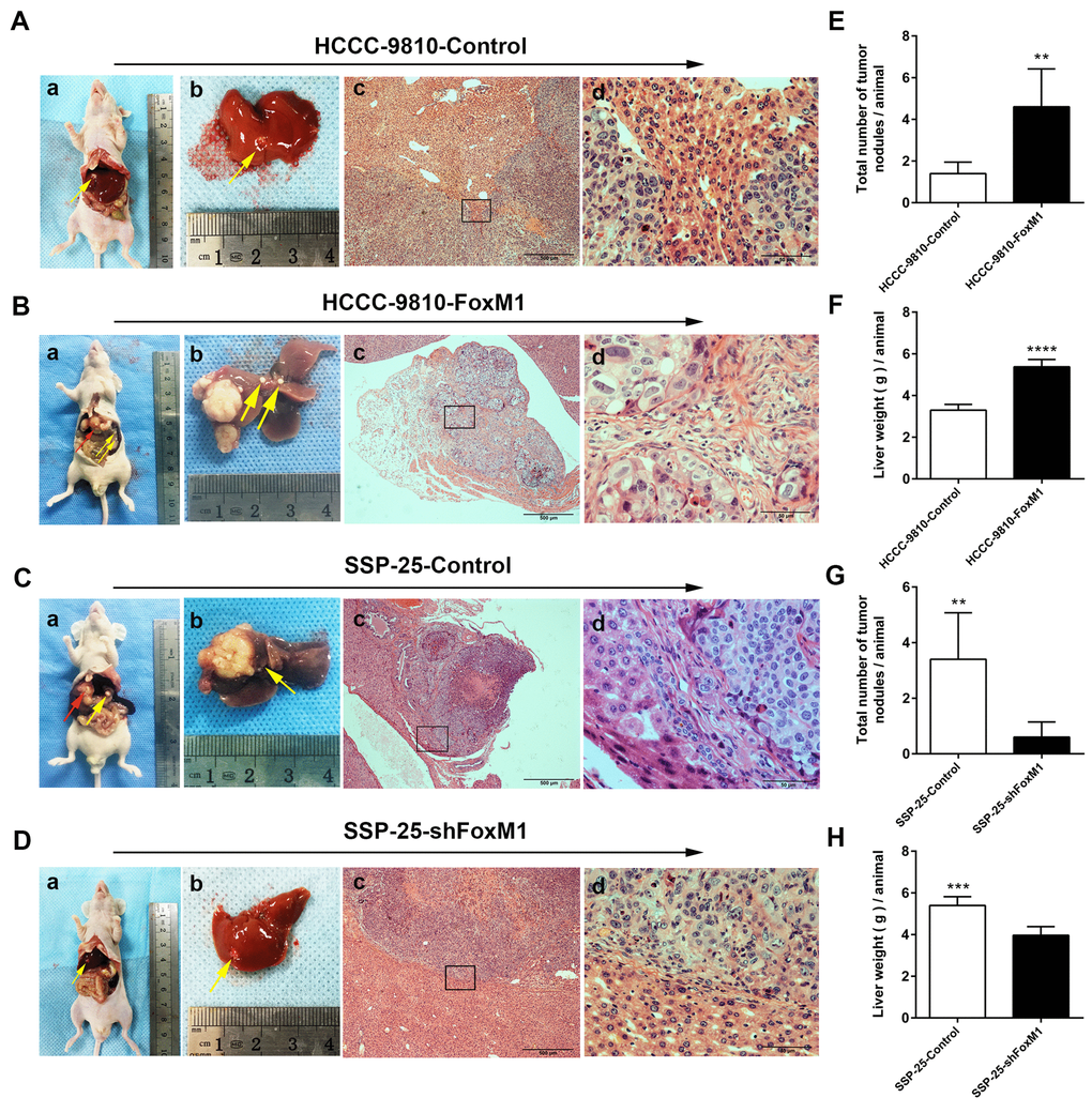 Overexpression of FoxM1 promoted ICC progression in vivo. Representative images of nude mouse ICC hepatic xenograft models (red arrow head show primary xenografted tumor, while the yellow arrow indicates metastasis in (B-a, B-b and C-a, C-b) and HE-stained sections (A-c, B-c, C-c, and D-c: magnification × 40; A-d, B-d, C-d, and D-d: magnification × 400). The total number of tumor nodules/animal (E, G) and liver weight (g)/animal (F, H) of the hepatic xenograft tumors showed marked differences between the experimental and control groups (n = 5 per group). Statistics are shown with a bar graph. **P ***P ****P 