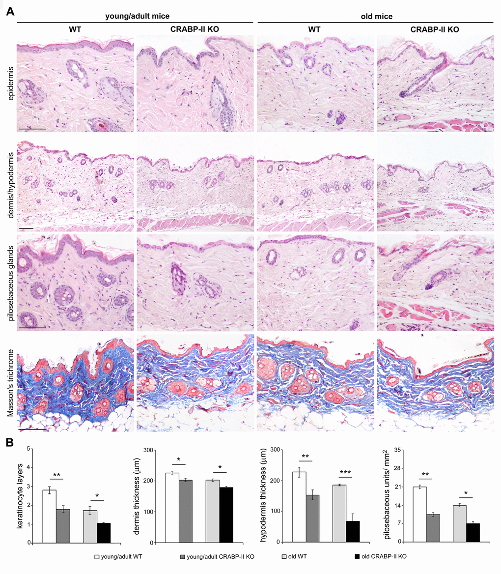 Skin aging histological features compare earlier and more pronounced in CRABP-IIknock-out mice. (A) Representative Haematoxylin&Eosin and Masson's trichrome-stained skin sections of young/adult and old wild-type (WT) and CRABP-II knock-out (KO) mice. (B) Bar graphs show semiquantitative evaluation of skin aging parameters (n=10 young/adult and n=10 old WT, n=10 young/adult and n=10 old CRABP-II KO). Scale bar: 100µm. Values are group mean ± SEM. t-Test: *, ** and *** indicate pp p