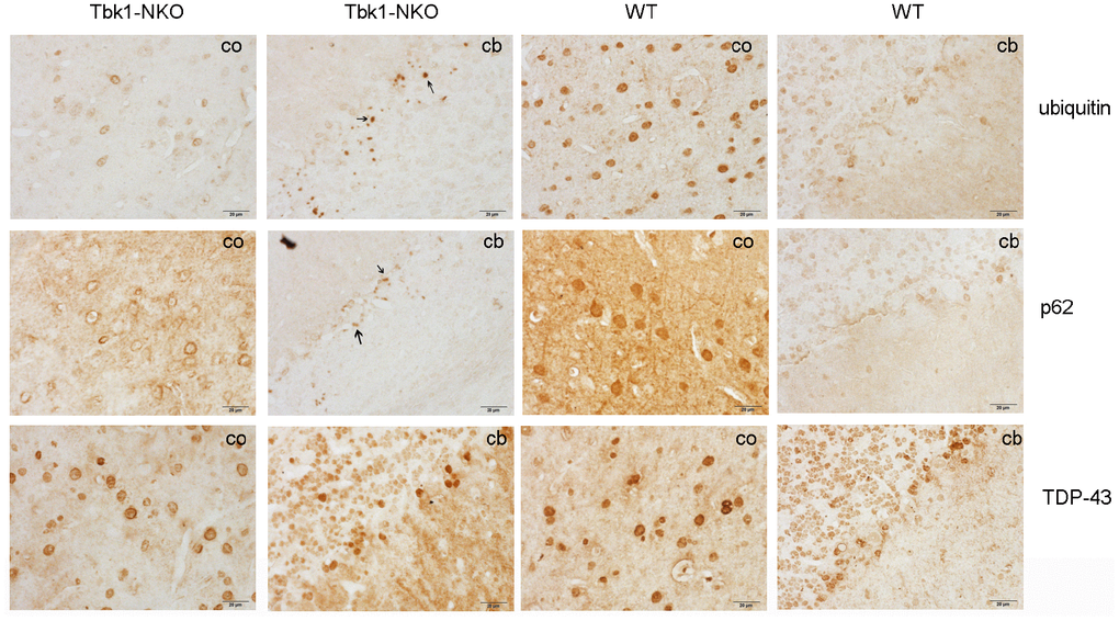 Identification of protein aggregates. Ubiquitin, p62, and TDP-43 immunostaining of the cortex (co) and cerebellum (cb) of Tbk1-NKO and WT mice (n = 3). Bar = 20 μm. Arrows indicate protein aggregates.