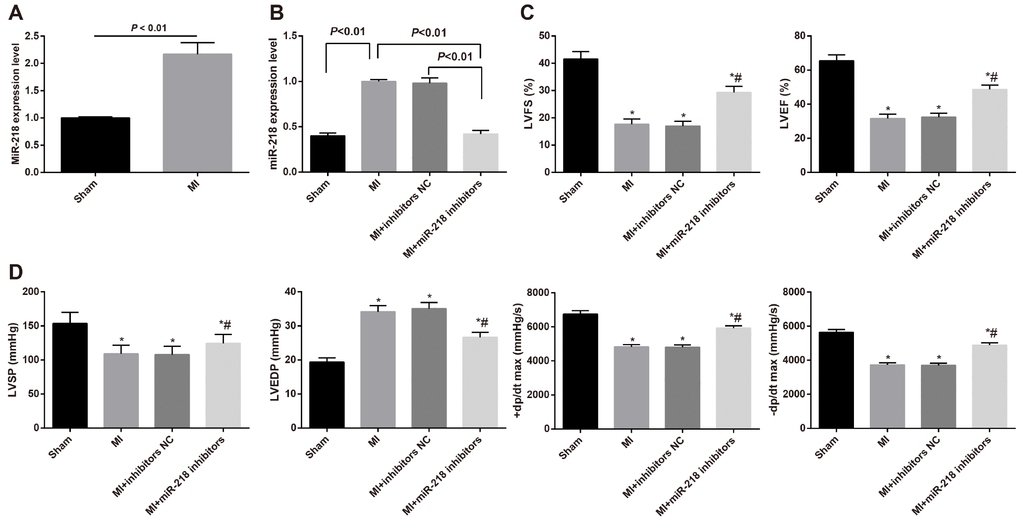 MiR-218 is highly expressed in cardiac tissues and downregulated miR-218 improved cardiac function in MI rats. (A) miR-218 expression in cardiac tissues of rats in the sham group and MI group detected by RT-qPCR, n = 3; (B) miR-218 expression in cardiac tissues of MI rats of the MI group, the MI + inhibitors NC group and the MI + miR-218 inhibitors group, n = 3; (C) the LVEF and LVFS of rats detected by ultrasonic cardiogram, n = 12; (D) the LVSP, LVEDP, +dp/dt max and -dp/dt max of rats detected by hemodynamic monitoring, n = 12; *versus the sham group, P P t test or one-way ANOVA. Pairwise comparison after ANOVA was performed by LSD-t. MI, myocardial infarction; miR-218, microRNA-218; LVEF, left ventricular ejection fraction; LVFS, left ventricular fraction shortening; LVSP, left ventricular systolic pressure; LVEDP, left ventricular end diastolic pressure; RT-qPCR, reverse transcription quantitative polymerase chain reaction.