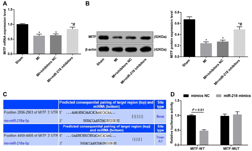 The targeting relationship between miR-218 and MITF is determined by bioinformatics prediction and a confirmatory dual-luciferase reporter gene assay. (A) the mRNA expression of MITF detected by RT-qPCR; (B) the protein expression of MITF detected by western blot assay; (C) the binding sites of miR-218 to MITF predicted by online software; (D) the targeting relationship of miR-218 and MITF determined by dual-luciferase reporter gene assay; (D) * versus the sham group, P P 