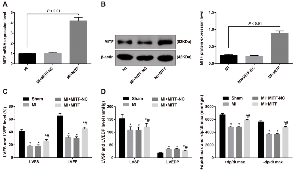 Upregulated MITF expression improves cardiac function in MI rats. (A) the mRNA expression of MITF in cardiac tissues of MI rats detected by RT-qPCR, n = 3; (B) the protein expression of MITF in cardiac tissues of MI rats detected by western blot assay, n = 3; (C) the LVEF and LVFS of rats detected by ultrasonic cardiogram, n = 12; (D) the LVSP, LVEDP, +dp/dt max and -dp/dt max of rats detected by hemodynamic monitoring, n = 12; * versus the sham group, P P t test or one-way ANOVA. Pairwise comparison after ANOVA was performed by LSD-t. MI, myocardial infarction; LVEF, left ventricular ejection fraction; LVFS, left ventricular fraction shortening; LVSP, left ventricular systolic pressure; LVEDP, left ventricular end diastolic pressure; RT-qPCR, reverse transcription quantitative polymerase chain reaction; MITF, microphthalmia-associated transcription factor.