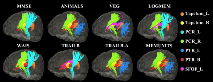 White matter fiber tracts in which WMLs made a higher contribution to the prediction of cognitive performances than lesions located in other brain areas. For each test, only the top 5 white matter tracts are displayed.
